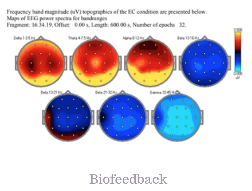 Capital Biofeedback | ( pic: capitalbiofeedback.com )